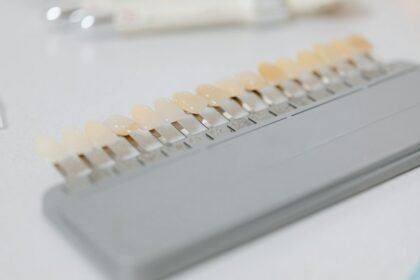 manchas blancas en los dientes